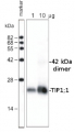 TIP1 | Tonoplast intrinsic protein 1-1